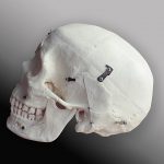Human demo skull divided into 14 pieces